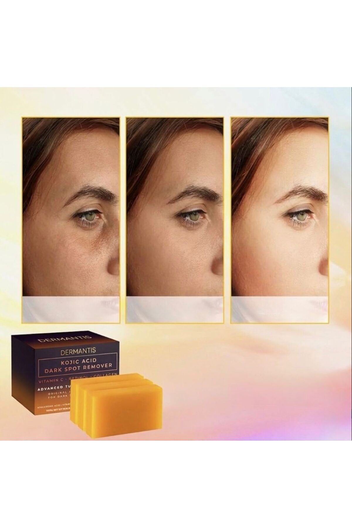 Kojik Asit Dipalmitat Sabunu: Leke Karşıtı, Beyazlatıcı, C Vitamini ve Retinol Etkili Kusursuz Cilt Bakım Seti, Ton Eşitleyici, Pürüzsüz ve Parlak Görünüm, Doğal Güvenli Form, Cilt Bakım Seti